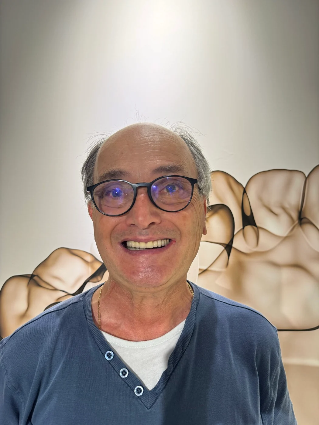 Full smile makeover